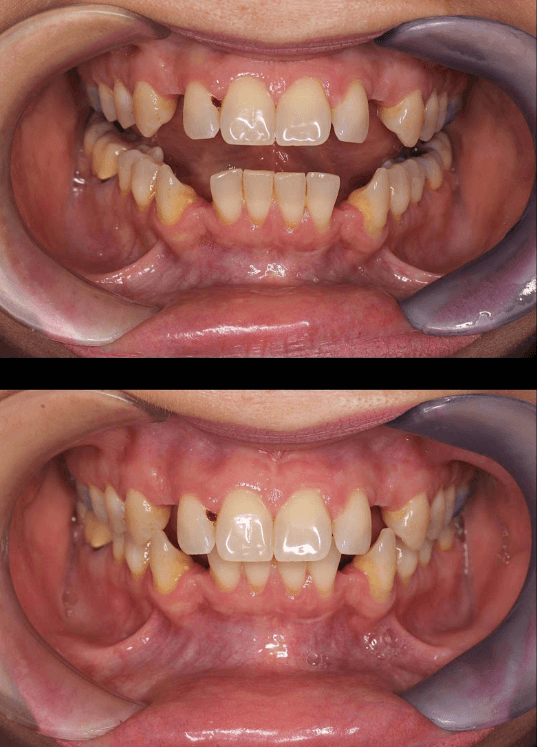 A Case That Defied Conventional Thinking, Front view, before treatment